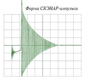 Форма импульса электростимулятора СКЭНАР